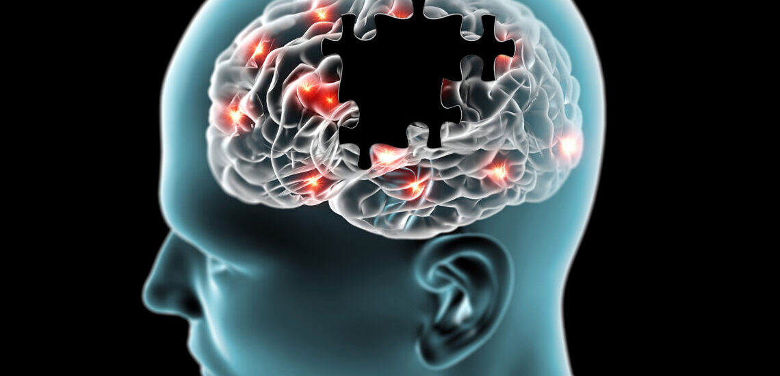 Choroba Parkinsona - jak wspiera ją fizjoterapia?